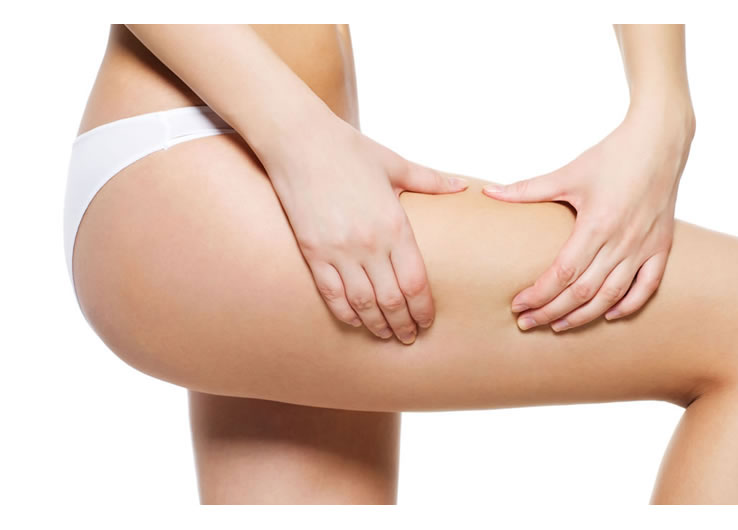 eliminar celulitis murcia