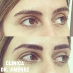 Micropigmentacion de cejas_2
